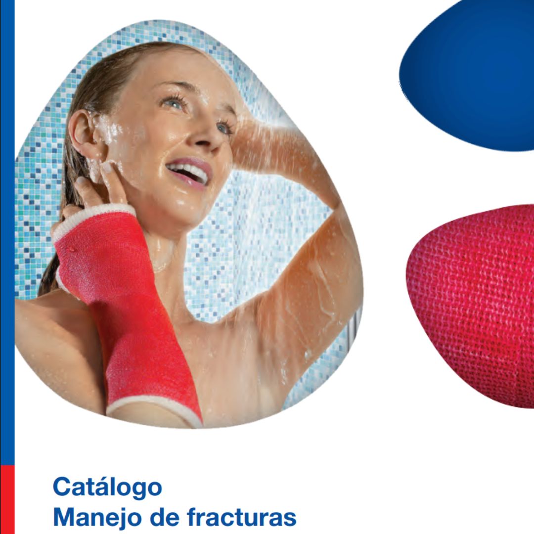 Manejo de Fracturas